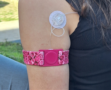 SURE-T INFÚZIÓS SZERELÉKHEZ -