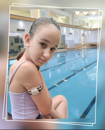 Szerelékpántok rugalmas anyagból - fedezd fel a DiabLife Shop kínálatát! kanülpánt - diablifeshop