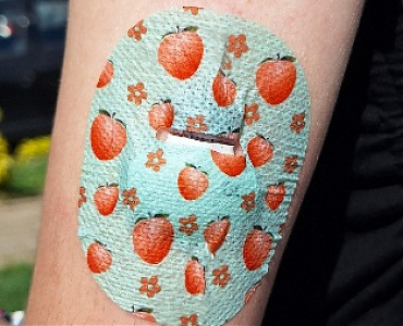 Medtronic (Enlite, Guardian 3, Guardian 4) - Lyukas és fedett kivitelben is!