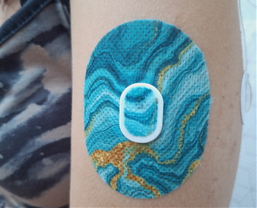 Sibionics GS3 szenzorhoz - Gyári kerethez is lyukas kivitelben, illetve gyári keret nélküli használathoz lyukas és fedett kivitelben is! A lyukas változat a szenzor köré és a tetejére is illeszkedik, míg a fedett típus egyetlen mozdulattal, teljes felületen takarja az eszközt.